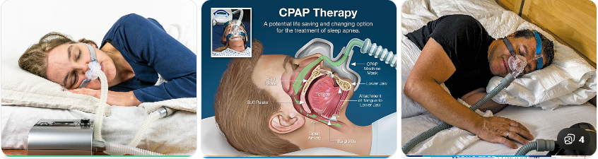 코골이 치료 (양압기)