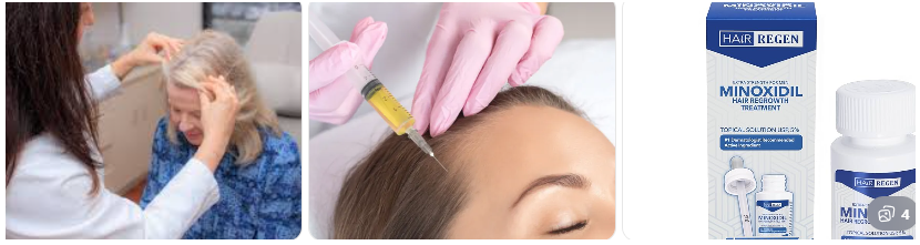 탈모시술비용 탈모시술비용