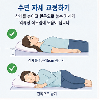 역류성 식도염 수면 자세 상체 높이기 왼쪽으로 눕기 위산 역류 방지 이미지