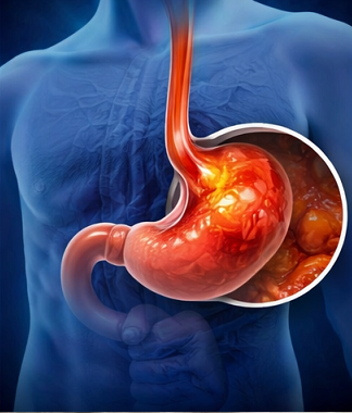 위산 역류로 식도가 자극되는 위장 일러스트