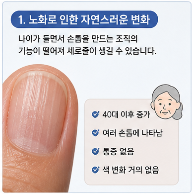 노화로 인한 손톱 세로줄