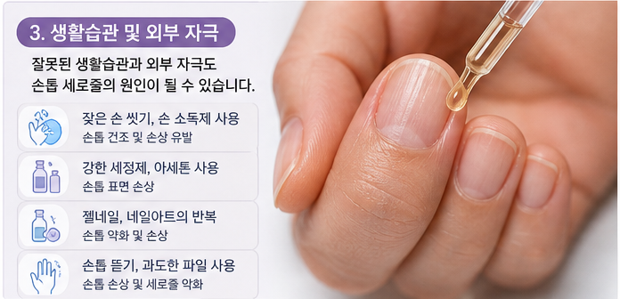 생활습관 및 외부자극으로 인한 손톱 세로줄