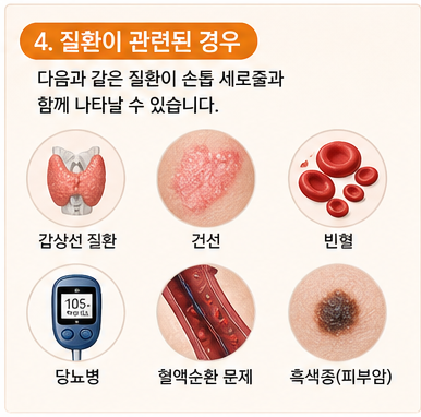 질환으로 인한 손톱 세로줄