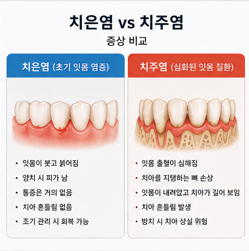 치은염과 치주염의 차이점 및 주요 증상을 비교