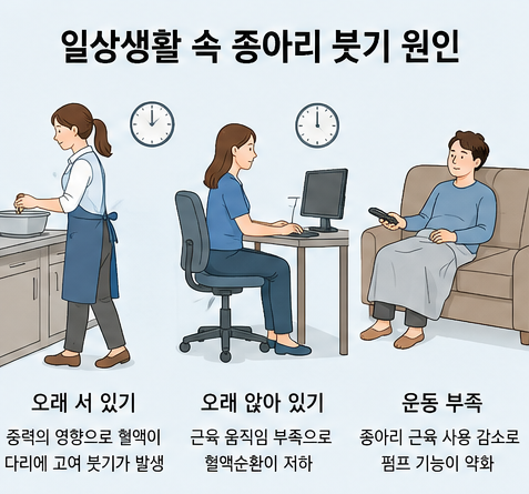 오래 서 있기, 오래 앉아 있기, 운동 부족 등 일상생활 속 종아리 붓기 원인을 설명한 인포그래픽