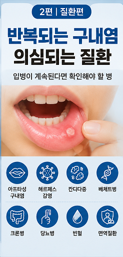 반복되는 구내염 의심되는 질환