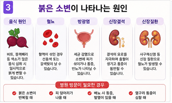 붉은 소변이 나타나는 원인