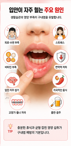 입안이 자주 헐는 구내염 주요 원인