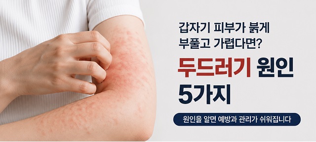 두드러기 원인