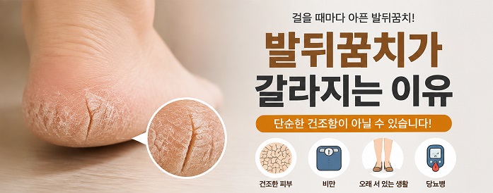 발뒤꿈치가 갈라지는 이유