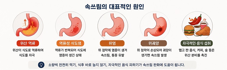 속쓰림의 대표적인 원인