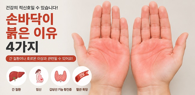손바닥이 붉은 이유