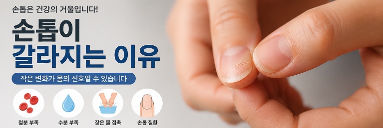 손톱이 갈라지는 이유
