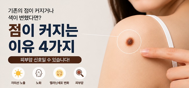 점이 커지는 이유