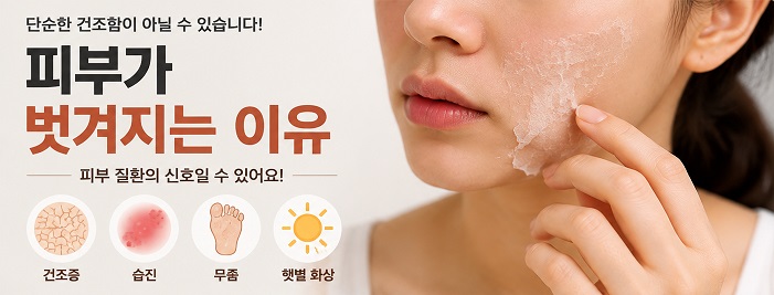 피부가 벗겨지는 이유